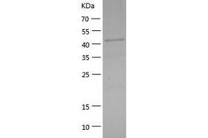 Western Blotting (WB) image for GATA Binding Protein 1 (Globin Transcription Factor 1) (GATA1) (AA 2-413) protein (His tag) (ABIN7285454) (GATA1 Protein (AA 2-413) (His tag))