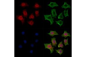 ABIN7094280 and ABIN7098327 staining HepG2 cells by IF/ICC.