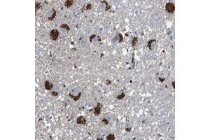 Immunohistochemical staining of human hippocampus with CYP2W1 polyclonal antibody  shows strong cytoplasmic positivity, with a granular pattern, in neuronal and glial cells. (CYP2W1 抗体)
