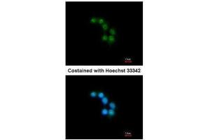 ICC/IF Image Immunofluorescence analysis of methanol-fixed HepG2, using STXBP2, antibody at 1:200 dilution. (STXBP2 抗体)