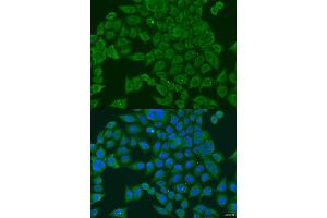 Immunofluorescence analysis of U2OS cells using PIWIL1 antibody (ABIN2564557) at dilution of 1:100. (PIWIL1 抗体)