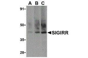Western Blotting (WB) image for anti-Single Immunoglobulin and Toll-Interleukin 1 Receptor (TIR) Domain (SIGIRR) (C-Term) antibody (ABIN2476474) (SIGIRR 抗体  (C-Term))