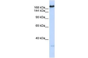 CAD antibody used at 1 ug/ml to detect target protein. (CAD 抗体  (C-Term))