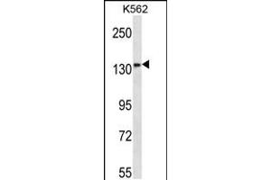Western blot analysis in K562 cell line lysates (35ug/lane). (Meningioma 1 抗体  (AA 835-864))