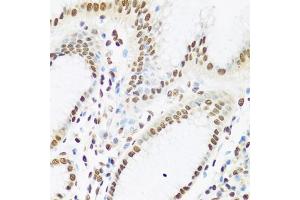 Immunohistochemistry of paraffin-embedded human stomach using Ku80 antibody (ABIN6130932, ABIN6150308, ABIN6150310 and ABIN6217336) at dilution of 1:100 (40x lens). (XRCC5 抗体  (AA 540-732))