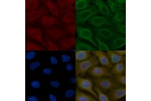 ARHGAP42 Mouse Monoclonal Antibody staining Hela cells by IF/ICC.