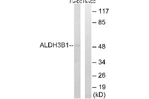 Immunohistochemistry analysis of paraffin-embedded human breast carcinoma tissue, using ALDH3B1 antibody.