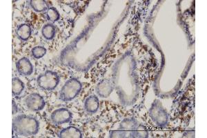 Immunoperoxidase of monoclonal antibody to HSD17B1 on formalin-fixed paraffin-embedded human small Intestine. (HSD17B1 抗体  (AA 189-285))