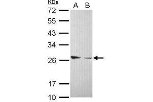 WB Image Sample (30 ug of whole cell lysate) A: IMR32 B: U87-MG 12% SDS PAGE antibody diluted at 1:1000 (Amphiregulin 抗体)