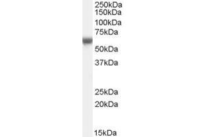 Western Blotting (WB) image for anti-Fatty Acid Desaturase Domain Family, Member 6 (FADS6) (C-Term) antibody (ABIN2791499) (FADS6 抗体  (C-Term))