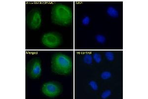 ABIN570956 Immunofluorescence analysis of paraformaldehyde fixed U2OS cells, permeabilized with 0. (PSMG1 抗体  (C-Term))