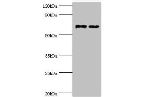 Western blot All lanes: Myotubularin-related protein 14 antibody at 10 μg/mL Lane 1: Hela whole cell lysate Lane 2: Mouse skeletal muscle tissue Secondary Goat polyclonal to rabbit IgG at 1/10000 dilution Predicted band size: 73, 67, 61 kDa Observed band size: 73 kDa (MTMR14 抗体  (AA 1-280))