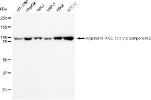 Western blotting analysis using Argonaute RISC catalytic component 2 antibody (ABIN7797650). (Recombinant AGO2 抗体)