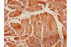 Immunohistochemistry (IHC) image for anti-Actin, alpha 1, Skeletal Muscle (ACTA1) (AA 3-377) antibody (ABIN7143128)