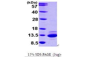 SDS-PAGE (SDS) image for Catenin, beta Interacting Protein 1 (CTNNBIP1) (AA 1-81) protein (His tag) (ABIN667025) (CTNNBIP1 Protein (AA 1-81) (His tag))