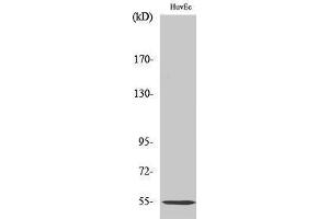 Western Blotting (WB) image for anti-Serpin Peptidase Inhibitor, Clade G (C1 Inhibitor), Member 1 (SERPING1) (Internal Region) antibody (ABIN3183585) (SERPING1 抗体  (Internal Region))