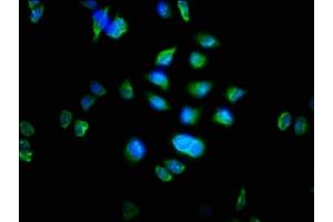 Immunofluorescence staining of Hela cells with ABIN7162762 at 1:100, counter-stained with DAPI. (MTRF1 抗体  (AA 285-433))