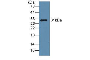 Western blot analysis of recombinant Mouse GAL3. (Galectin 3 抗体  (AA 2-264))