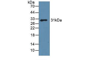 Western blot analysis of recombinant Mouse GAL3. (Galectin 3 抗体  (AA 2-264))