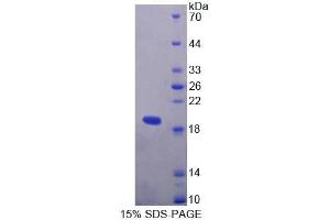 TIAM1 Protein (AA 1261-1397) (T7 tag,His tag)