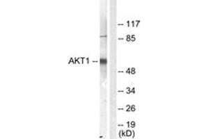 Western blot analysis of extracts from NIH-3T3 cells, treated with Serum 10% 30', using Akt (Ab-450) Antibody. (AKT1 抗体  (AA 416-465))