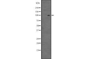 Western blot analysis of MYOCD expression in HEK293 cells ,The lane on the left is treated with the antigen-specific peptide. (Myocardin 抗体  (Internal Region))