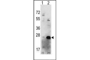 Western blot analysis of CSNK2B (arrow) using rabbit polyclonal CSNK2B Antibody (CSNK2B 抗体  (C-Term))