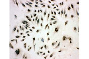Anti-MCM3 antibody, ICC ICC: HELA Cell (MCM3 抗体  (N-Term))