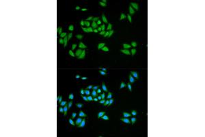 Immunofluorescence analysis of HeLa cells using UPF1 antibody. (RENT1/UPF1 抗体)