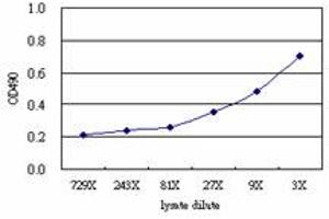 CTH (Human) Matched Antibody Pair