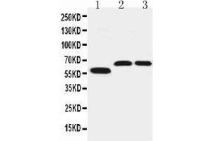 Anti-SLC1A4 antibody, Western blotting Lane 1: U87 Cell Lysate Lane 2: Rat Brain Tissue Lysate Lane 3: Mouse Brain Tissue Lysate (SLC1A4 抗体  (C-Term))