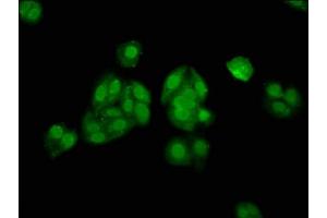 Immunofluorescence staining of HepG2 cells with ABIN7155641 at 1:133, counter-stained with DAPI. (ALX3 抗体  (AA 11-127))