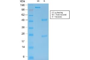 SDS-PAGE Analysis Purified MMP9 Mouse Recombinant Monoclonal Antibody (rMMP9/1769).