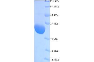 SDS-PAGE (SDS) image for Polymerase (DNA Directed), gamma (POLG) (AA 571-857) protein (His tag) (ABIN5714074)