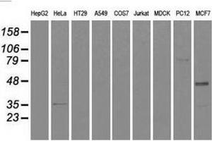 Western blot analysis of extracts (35 µg) from 9 different cell lines by using anti-CD4 monoclonal antibody. (CD4 抗体)