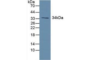 Western blot analysis of Human Lung Tissue. (Growth Hormone Receptor 抗体  (AA 315-574))
