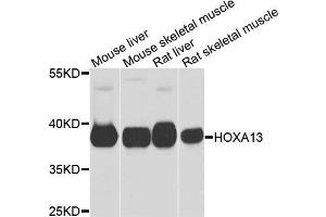 Western blot analysis of extracts of various cells, using HOXA13 antibody. (HOXA13 抗体)