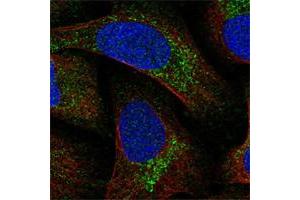 Immunofluorescent staining of human cell line U-2 OS shows positivity in vesicles. (MITD1 抗体)