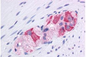 Human Colon, Myenteric Plexus: Formalin-Fixed, Paraffin-Embedded (FFPE) (HSP90AA1 抗体  (AA 108-157))