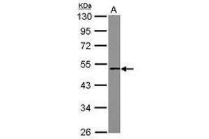 Image no. 1 for anti-Phosphate Cytidylyltransferase 1, Choline, beta (PCYT1B) (Internal Region) antibody (ABIN1496101) (PCYT1B 抗体  (Internal Region))