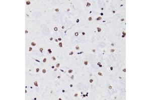 Immunohistochemistry of paraffin-embedded rat brain using H3K18ac antibody (ABIN7267668) at dilution of 1:100 (40x lens).