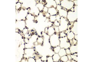 Immunohistochemistry of paraffin-embedded mouse lung using PHF11 antibody at dilution of 1:100 (x400 lens).
