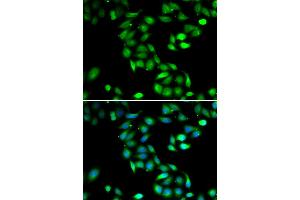 Immunofluorescence analysis of HeLa cells using PDCD6 antibody (ABIN5974030). (PDCD6 抗体)