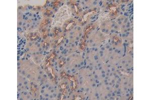 IHC-P analysis of kidney tissue, with DAB staining. (ABCC6 抗体  (AA 1260-1498))