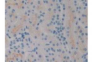 IHC-P analysis of Rat Kidney Tissue, with DAB staining. (SPRY2 抗体  (AA 116-304))