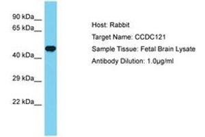 Image no. 1 for anti-Coiled-Coil Domain Containing 121 (CCDC121) (AA 197-246) antibody (ABIN6750672) (CCDC121 抗体  (AA 197-246))