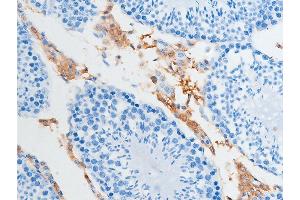 ABIN6255391 and ABIN6267252 at 1/100 staining rat testicular tissue sections by IHC-P. (CHEK2 抗体  (pSer516))