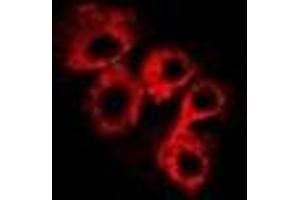 Immunofluorescent analysis of C4BP beta staining in Hela cells. (C4BPB 抗体)
