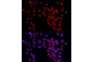Immunofluorescence analysis of HeLa cells using YE Rabbit pAb (ABIN6130808, ABIN6150331, ABIN6150332 and ABIN6221925) at dilution of 1:50 (40x lens). (GAS41 抗体  (AA 1-227))
