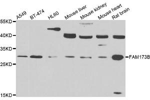 Western blot analysis of extracts of various cell lines, using FAM173B antibody. (FAM173B 抗体)